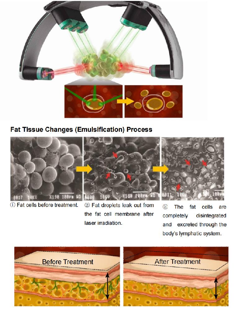 emerald laser non-invasive body slimming medical beauty machine